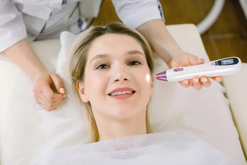 Uklanjanje kapilara Zagreb | Fotokoagulacija laser capillaries face